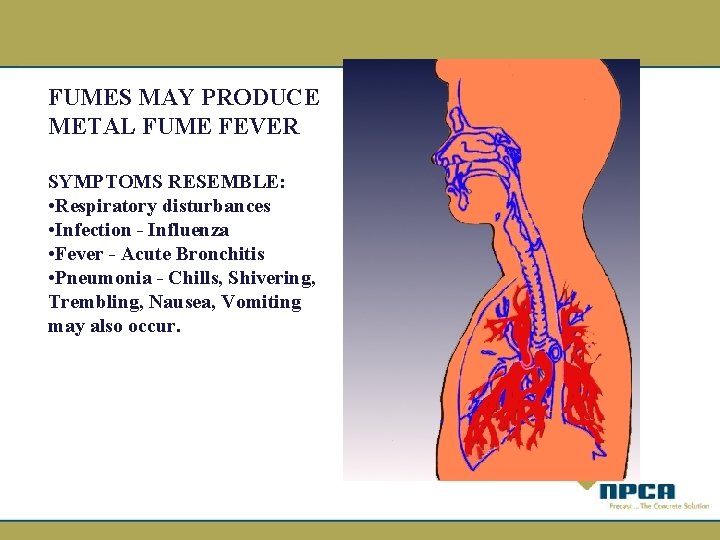 FUMES MAY PRODUCE METAL FUME FEVER SYMPTOMS RESEMBLE: • Respiratory disturbances • Infection -