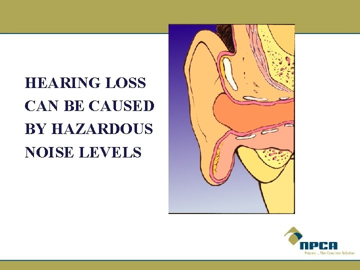 HEARING LOSS CAN BE CAUSED BY HAZARDOUS NOISE LEVELS 