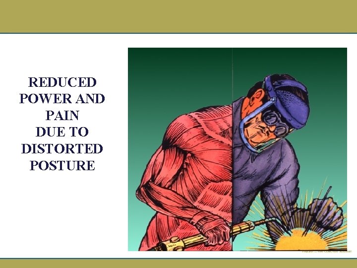 REDUCED POWER AND PAIN DUE TO DISTORTED POSTURE 