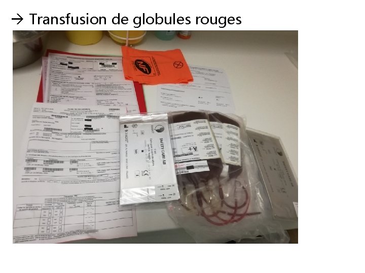  Transfusion de globules rouges 