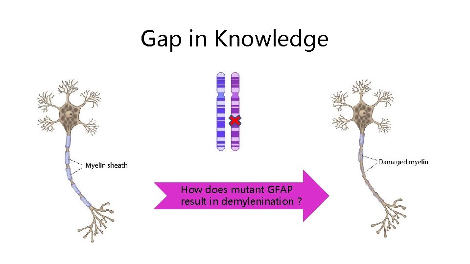 Gap in Knowledge How does mutant GFAP result in demylenination ? 
