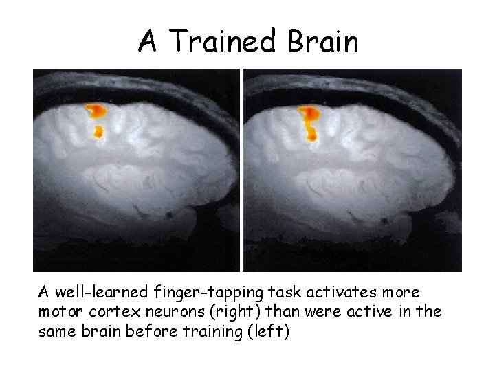 A Trained Brain A well-learned finger-tapping task activates more motor cortex neurons (right) than