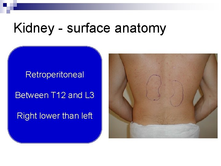 Kidney - surface anatomy Retroperitoneal Between T 12 and L 3 Right lower than