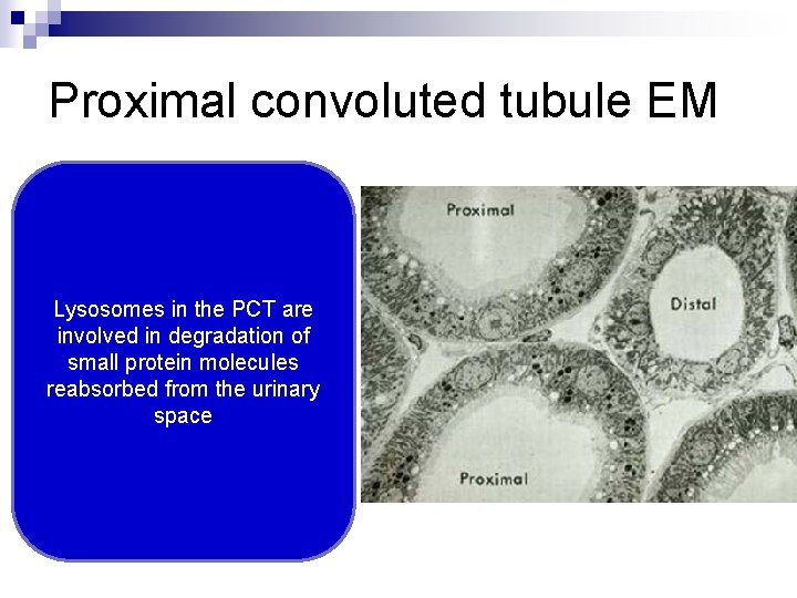 Proximal convoluted tubule EM Lysosomes in the PCT are involved in degradation of small