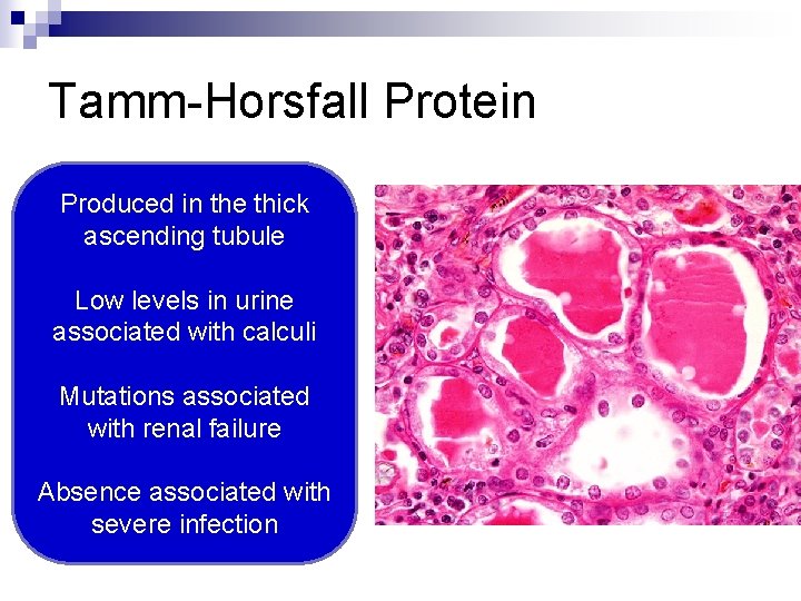 Tamm-Horsfall Protein Produced in the thick ascending tubule Low levels in urine associated with