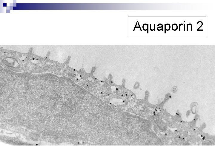 Aquaporin 2 