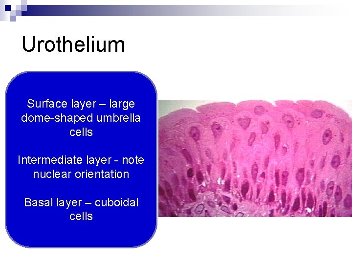 Urothelium Surface layer – large dome-shaped umbrella cells Intermediate layer - note nuclear orientation