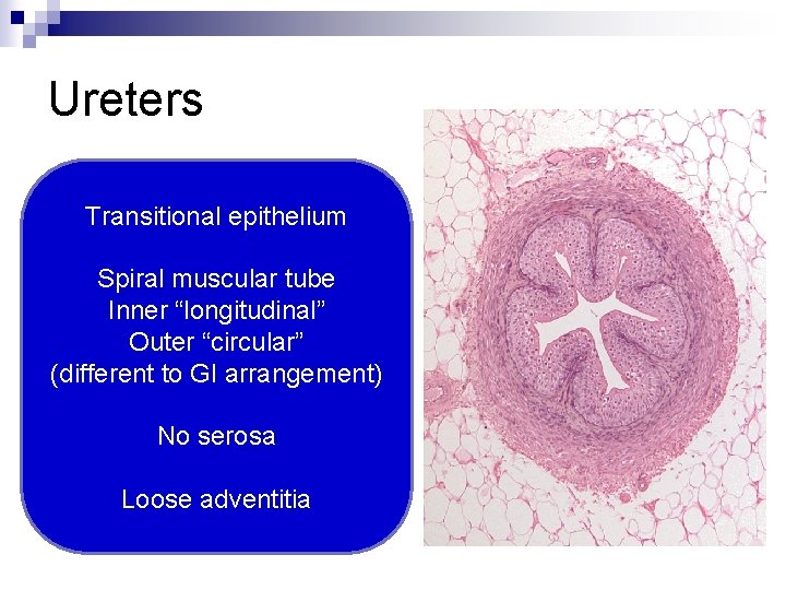 Ureters Transitional epithelium Spiral muscular tube Inner “longitudinal” Outer “circular” (different to GI arrangement)
