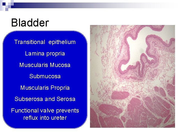 Bladder Transitional epithelium Lamina propria Muscularis Mucosa Submucosa Muscularis Propria Subserosa and Serosa Functional
