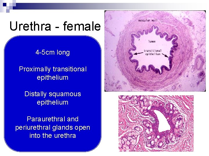 Urethra - female 4 -5 cm long Proximally transitional epithelium Distally squamous epithelium Paraurethral