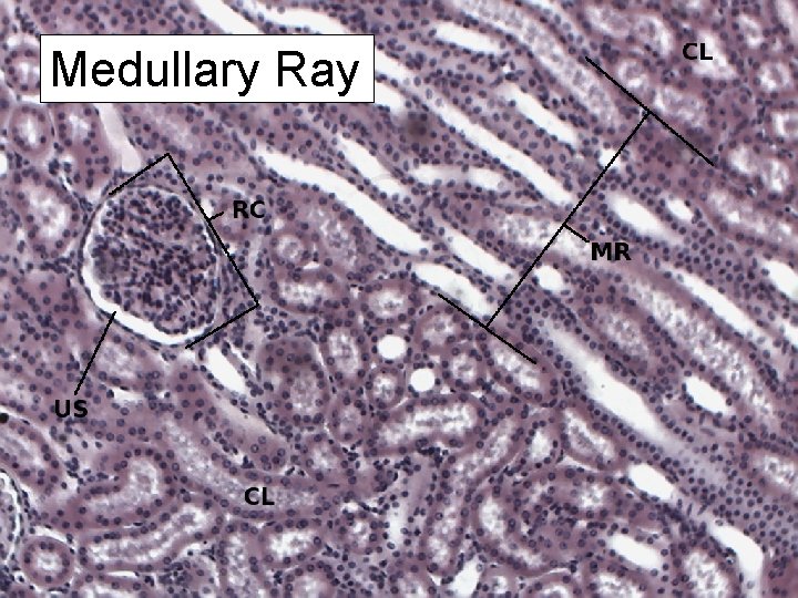 Medullary Ray 
