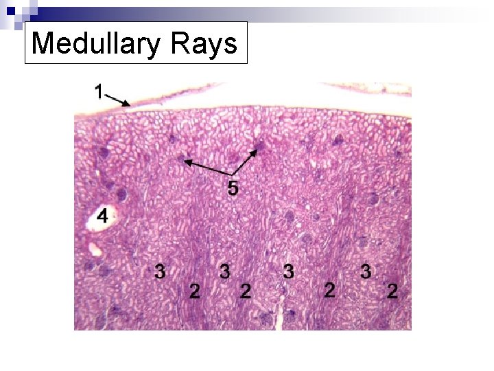 Medullary Rays 