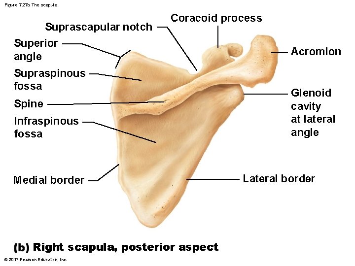 Figure 7. 27 b The scapula. Suprascapular notch Coracoid process Superior angle Supraspinous fossa