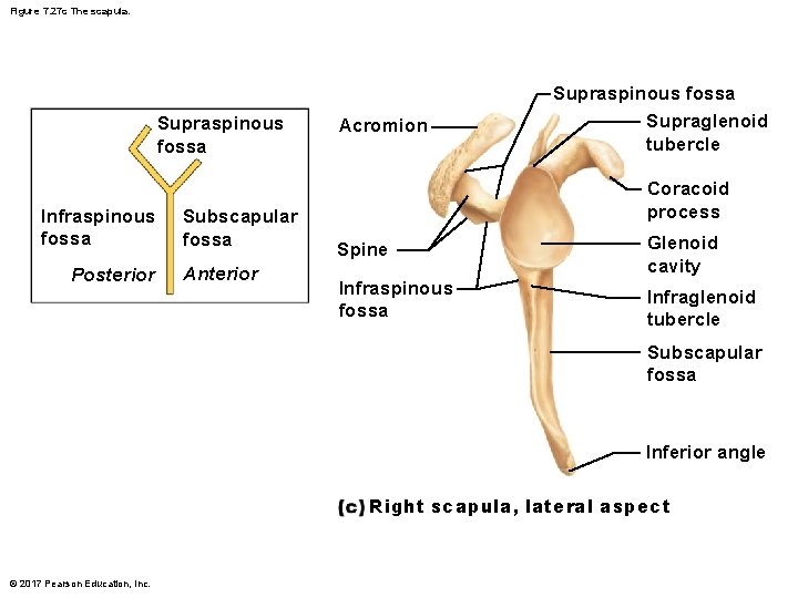 Figure 7. 27 c The scapula. Supraspinous fossa Infraspinous fossa Posterior Subscapular fossa Anterior