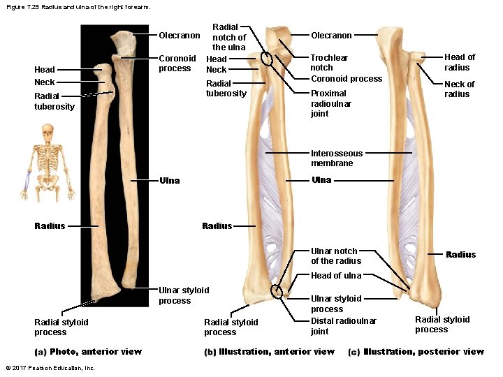 Figure 7. 29 Radius and ulna of the right forearm. Olecranon Head Neck Coronoid