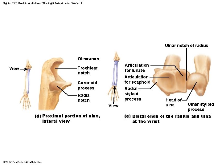 Figure 7. 29 Radius and ulna of the right forearm (continued). Ulnar notch of