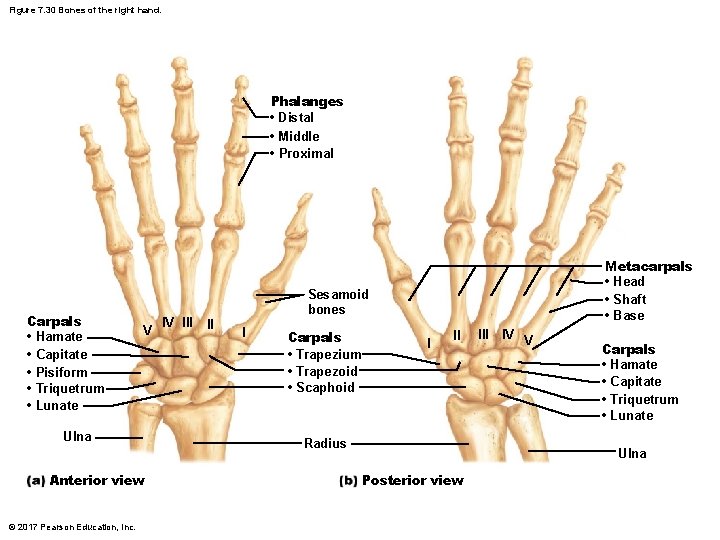 Figure 7. 30 Bones of the right hand. Phalanges • Distal • Middle •