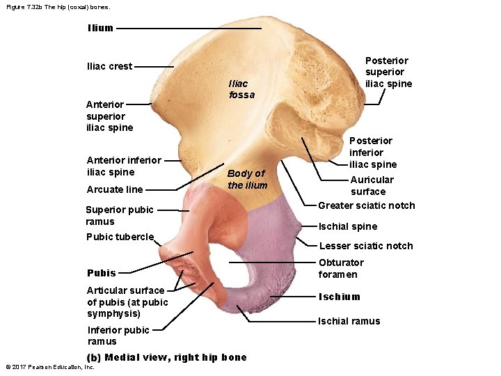 Figure 7. 32 b The hip (coxal) bones. Ilium Posterior superior iliac spine Iliac