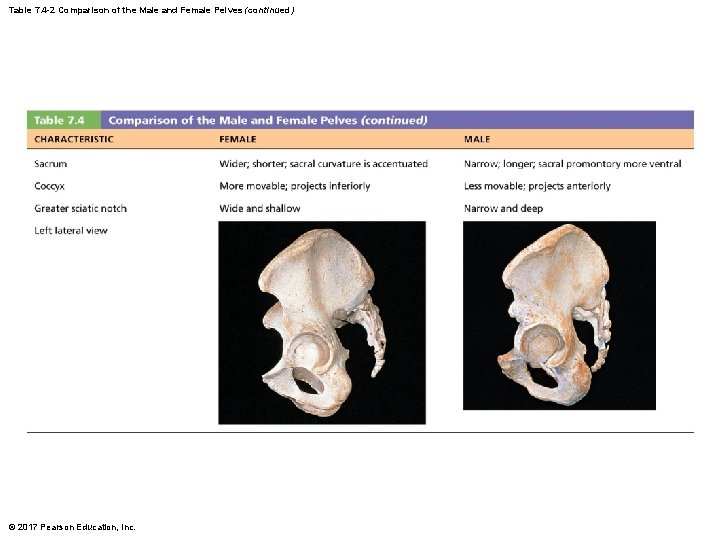 Table 7. 4 -2 Comparison of the Male and Female Pelves (continued) © 2017