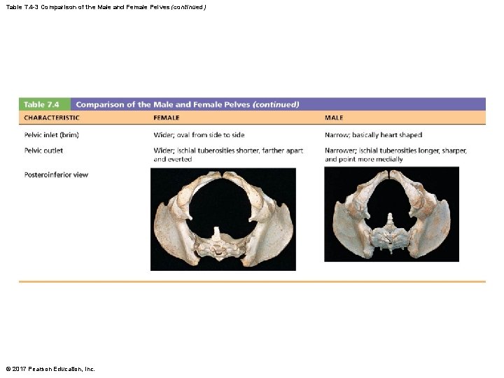 Table 7. 4 -3 Comparison of the Male and Female Pelves (continued) © 2017