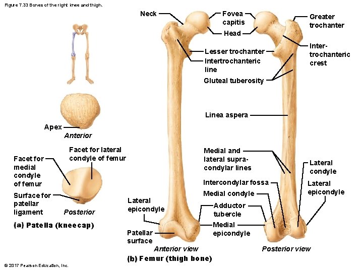Figure 7. 33 Bones of the right knee and thigh. Fovea capitis Neck Greater