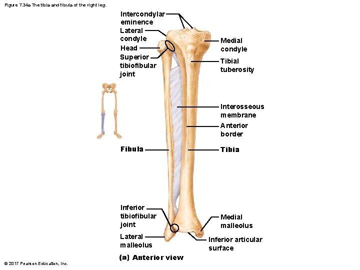 Figure 7. 34 a The tibia and fibula of the right leg. Intercondylar eminence