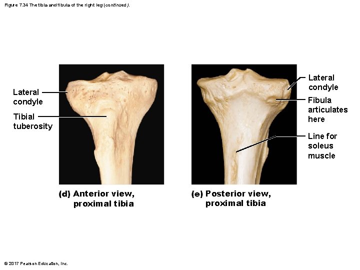 Figure 7. 34 The tibia and fibula of the right leg (continued). Lateral condyle