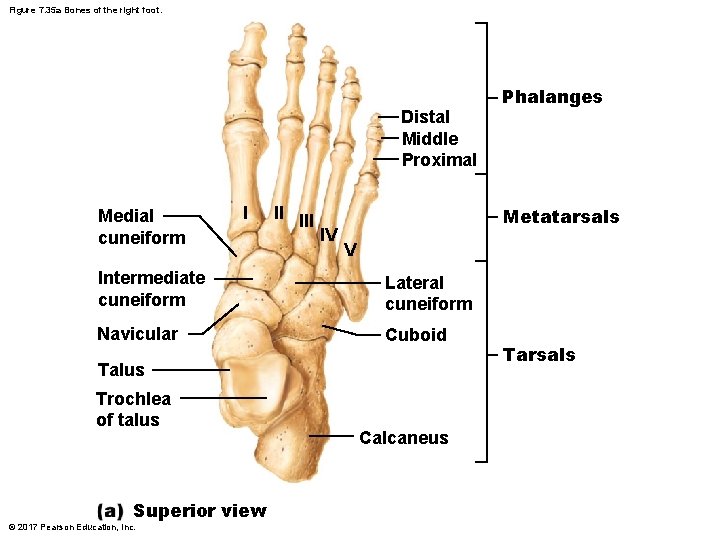 Figure 7. 35 a Bones of the right foot. Distal Middle Proximal Medial cuneiform