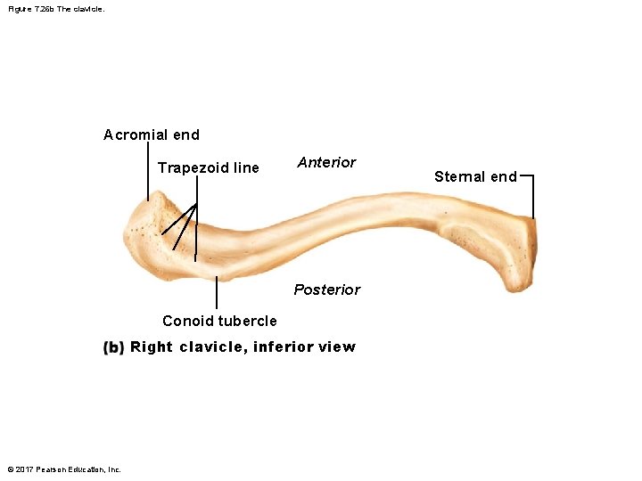 Figure 7. 26 b The clavicle. Acromial end Trapezoid line Anterior Posterior Conoid tubercle