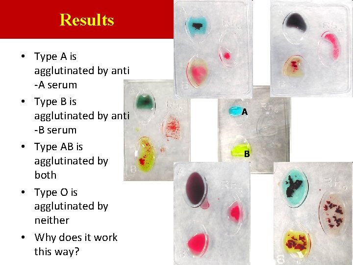 Results • Type A is agglutinated by anti -A serum • Type B is