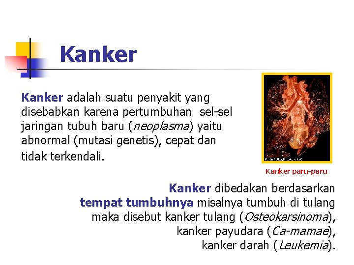 Kanker adalah suatu penyakit yang disebabkan karena pertumbuhan sel-sel jaringan tubuh baru (neoplasma) yaitu