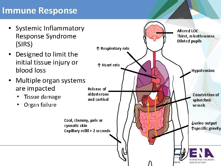Immune Response • Systemic Inflammatory Response Syndrome (SIRS) ↑ Respiratory rate • Designed to