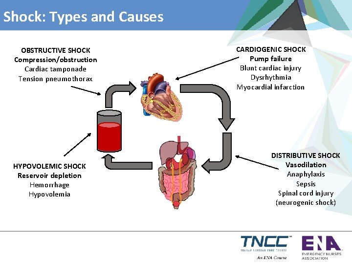 Shock: Types and Causes OBSTRUCTIVE SHOCK Compression/obstruction Cardiac tamponade Tension pneumothorax HYPOVOLEMIC SHOCK Reservoir