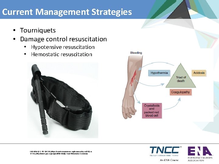 Current Management Strategies • Tourniquets • Damage control resuscitation • Hypotensive resuscitation • Hemostatic