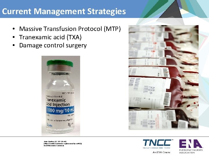 Current Management Strategies • Massive Transfusion Protocol (MTP) • Tranexamic acid (TXA) • Damage
