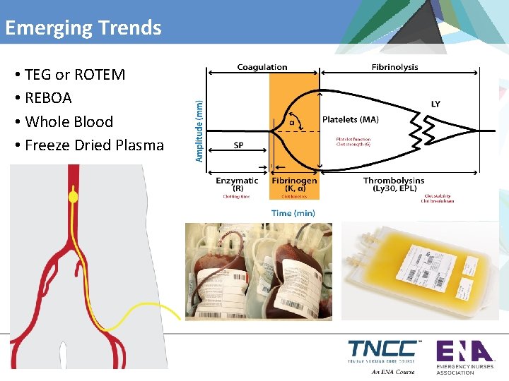 Emerging Trends • TEG or ROTEM • REBOA • Whole Blood • Freeze Dried