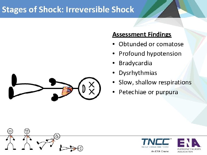 Stages of Shock: Irreversible Shock Assessment Findings • Obtunded or comatose • Profound hypotension