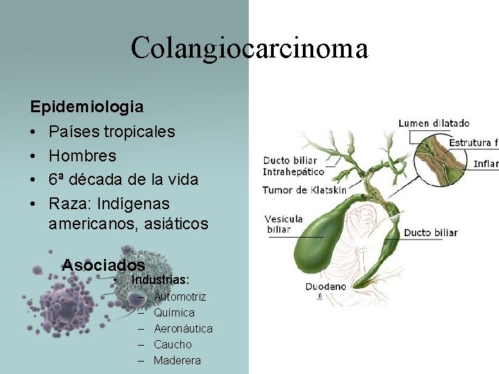 Colangiocarcinoma Epidemiologia • • Países tropicales Hombres 6ª década de la vida Raza: Indígenas