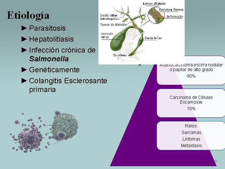 Etiología ► Parasitosis ► Hepatolitiasis ► Infección crónica de Salmonella ► Genéticamente ► Colangitis