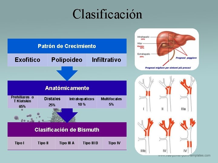 Clasificación Patrón de Crecimiento Exofitico Polipoideo Infiltrativo Anatómicamente Prehiliares o T Klatskin 65% Distales