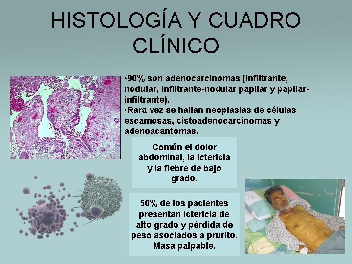 HISTOLOGÍA Y CUADRO CLÍNICO • 90% son adenocarcinomas (infiltrante, nodular, infiltrante-nodular papilar y papilarinfiltrante).