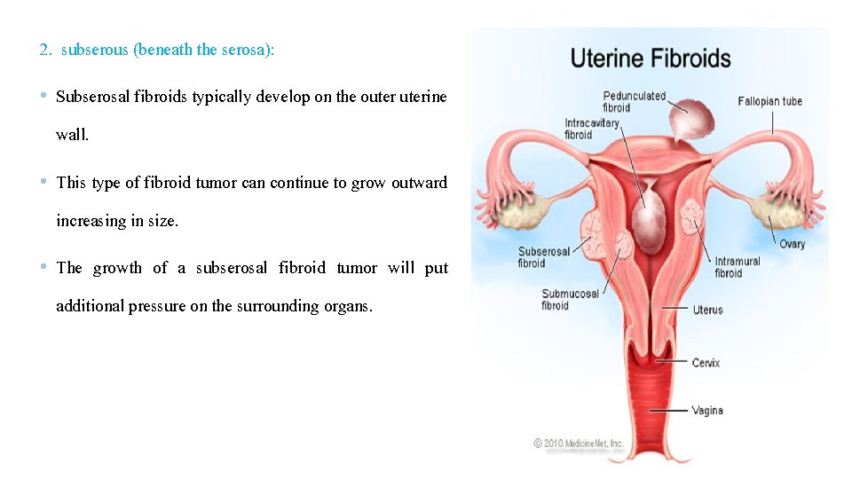 2. subserous (beneath the serosa): • Subserosal fibroids typically develop on the outerine wall.
