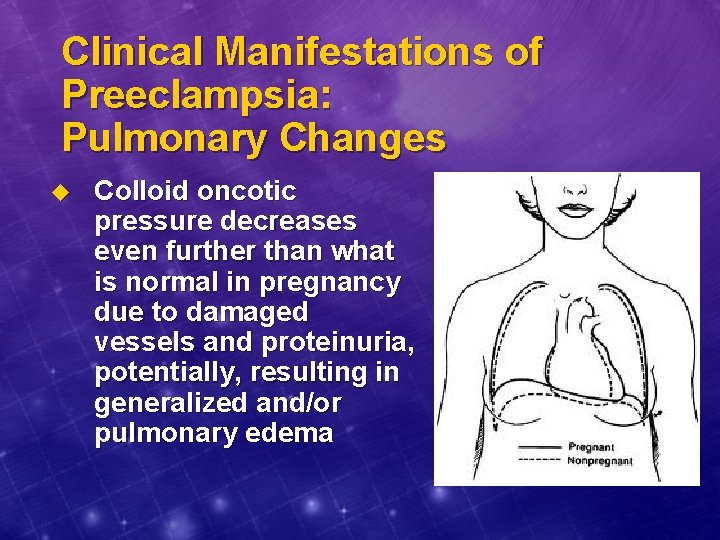 Clinical Manifestations of Preeclampsia: Pulmonary Changes u Colloid oncotic pressure decreases even further than