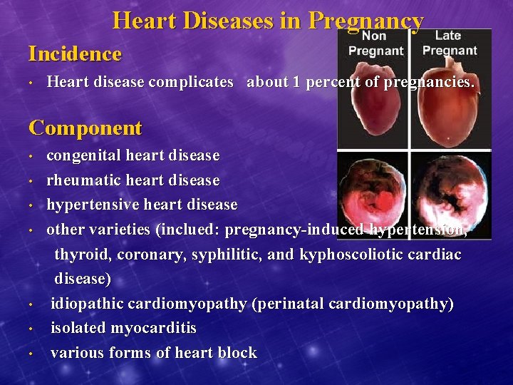 Heart Diseases in Pregnancy Incidence • Heart disease complicates about 1 percent of pregnancies.