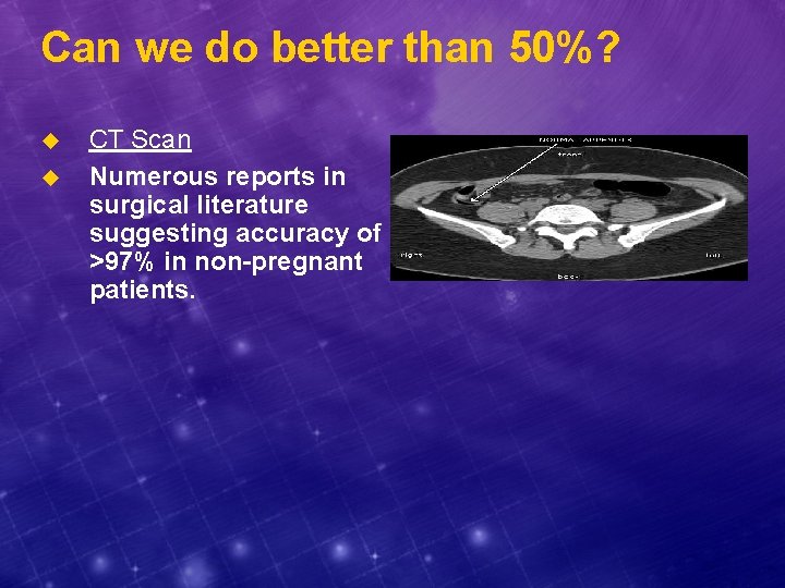 Can we do better than 50%? u u CT Scan Numerous reports in surgical