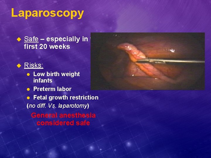 Laparoscopy u Safe – especially in the first 20 weeks u Risks: Low birth