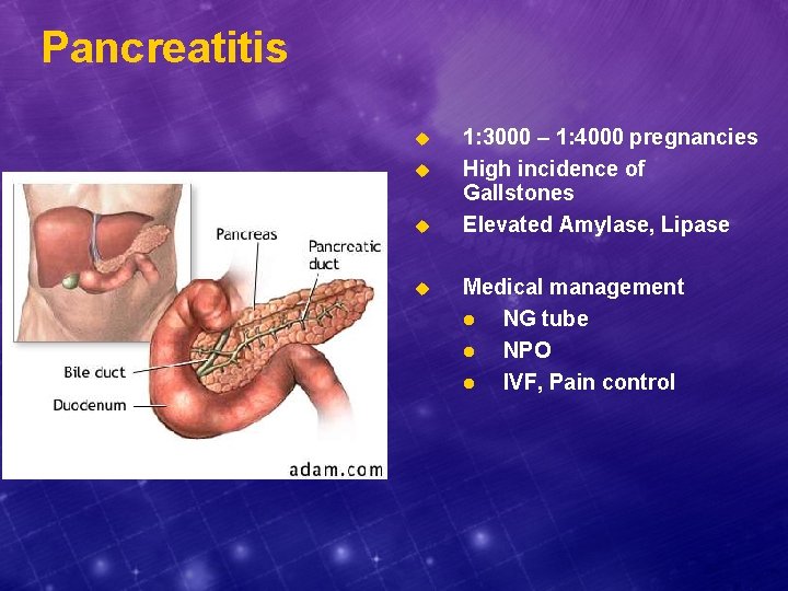 Pancreatitis u u 1: 3000 – 1: 4000 pregnancies High incidence of Gallstones Elevated