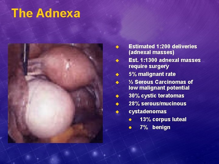 The Adnexa u u u u Estimated 1: 200 deliveries (adnexal masses) Est. 1: