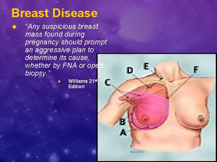 Breast Disease u “Any suspicious breast mass found during pregnancy should prompt an aggressive