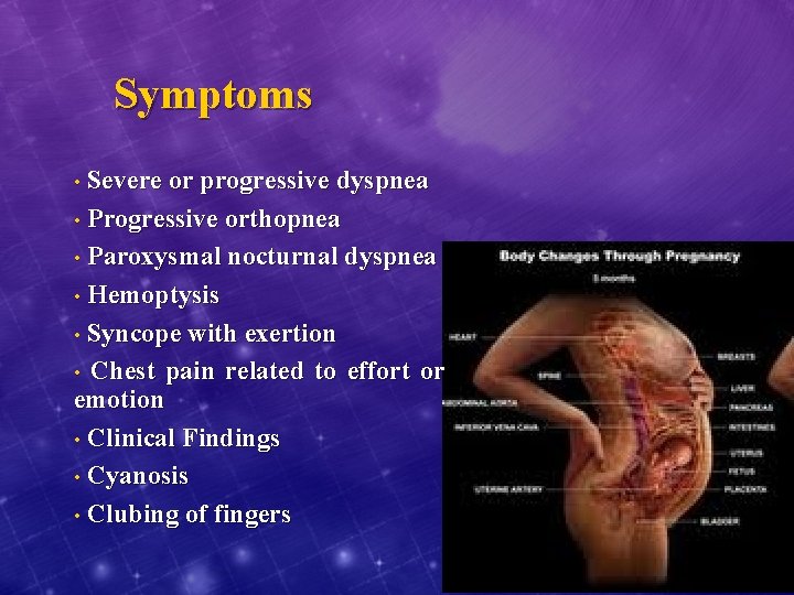 Symptoms • Severe or progressive dyspnea • Progressive orthopnea • Paroxysmal nocturnal dyspnea •